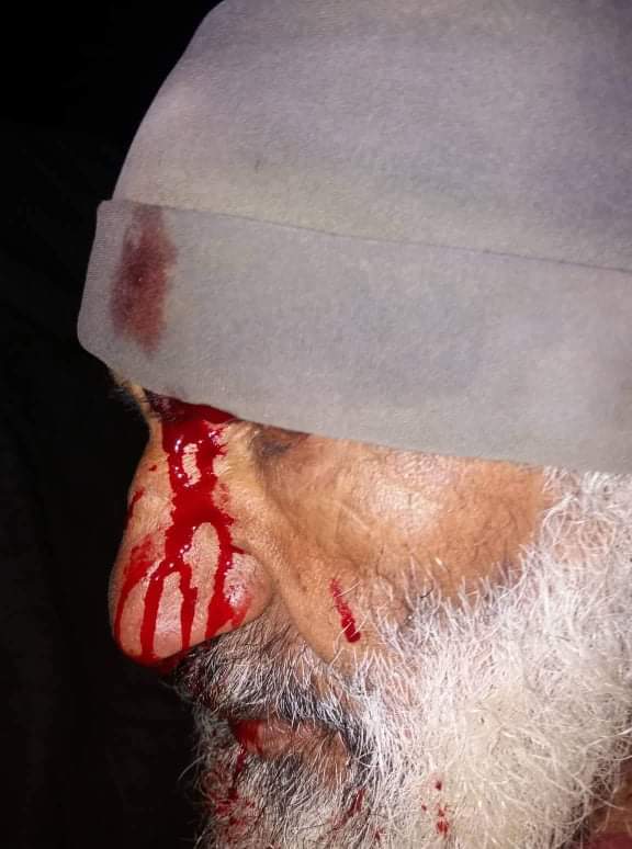 ח'ירבית ג'בעית, 16.2.20 ו- 5.3.20 - מתנחלים תקפו רועי צאן וגנבו 25 טלאים.